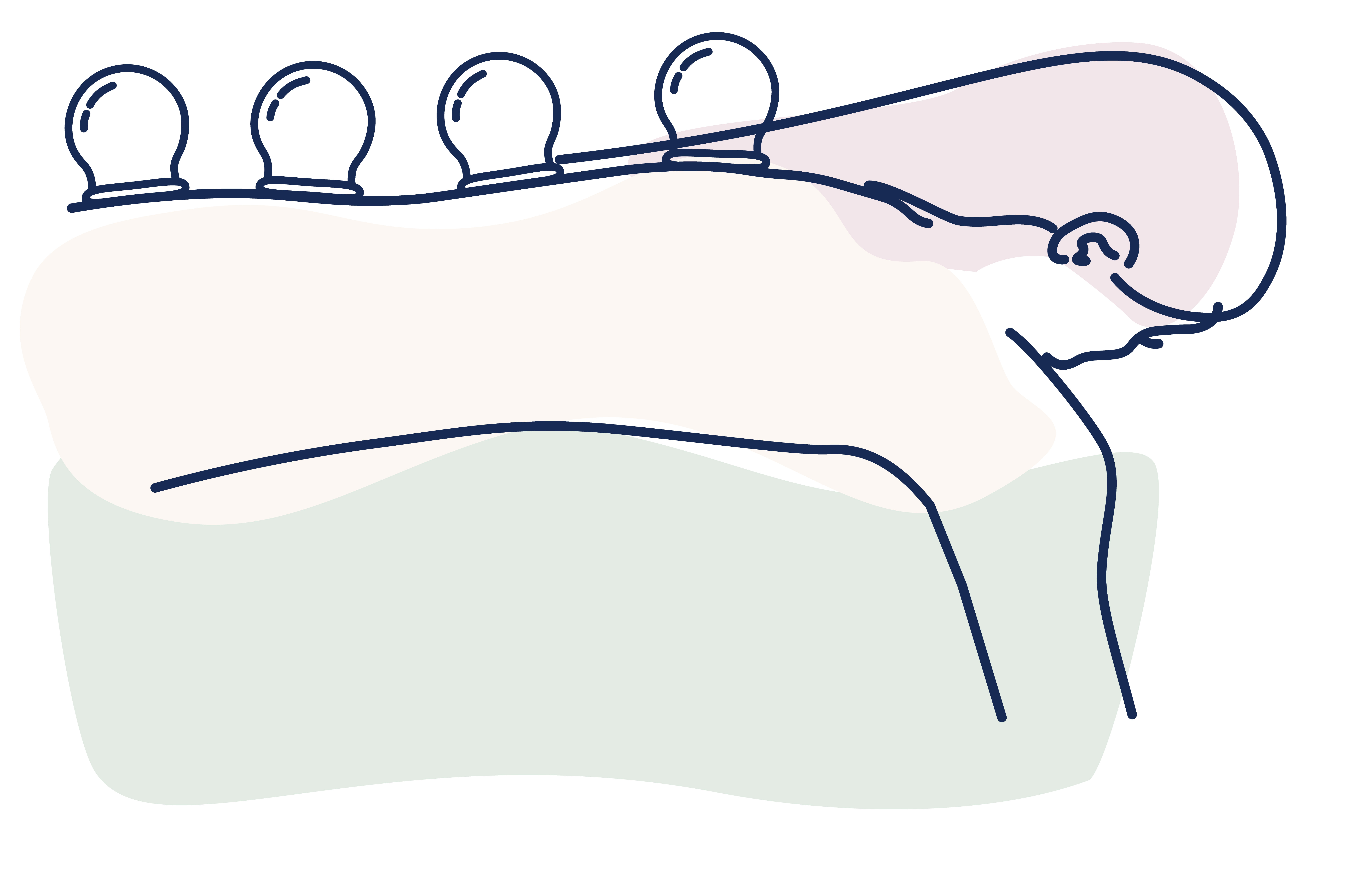 illustration of cupping massage