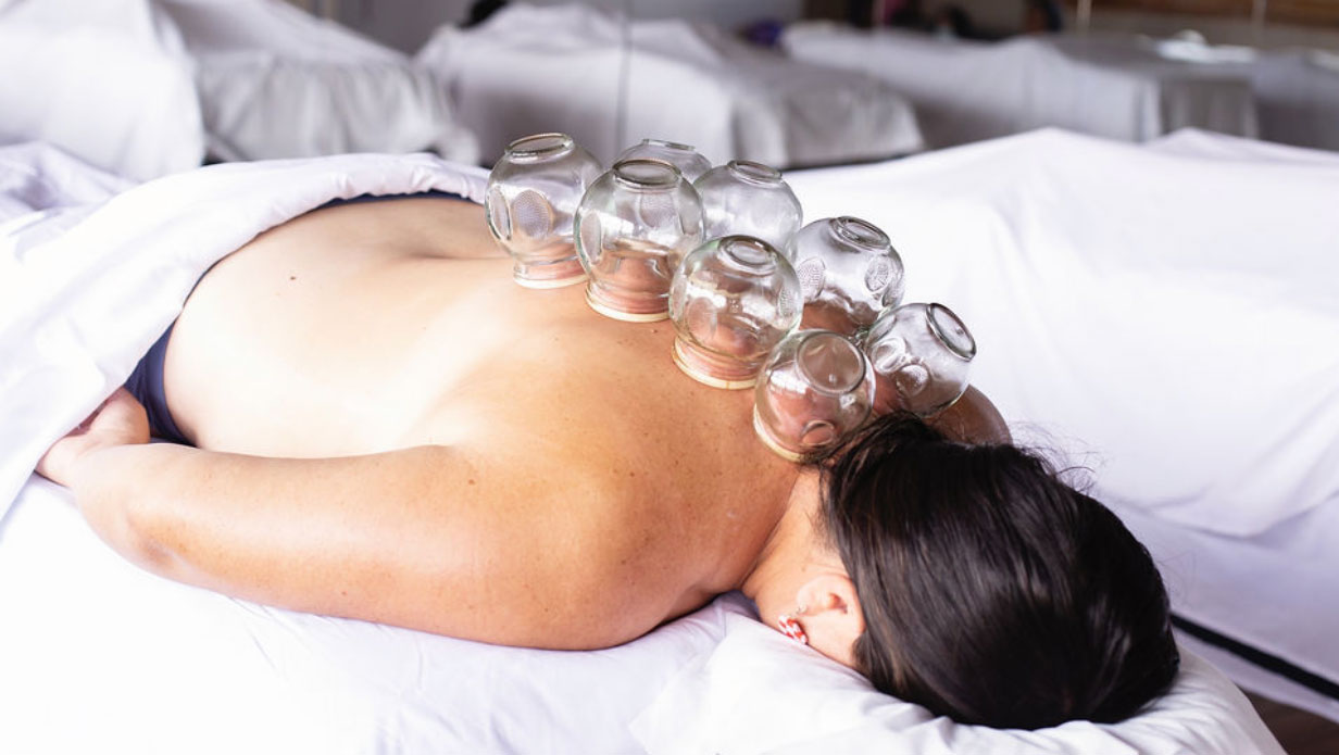 JKC WEllness cupping therapy