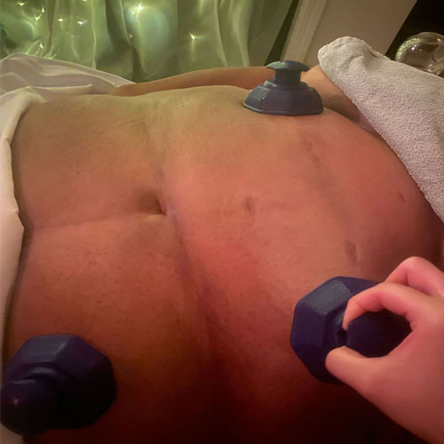 JKC Wellness stomach cupping therapy
