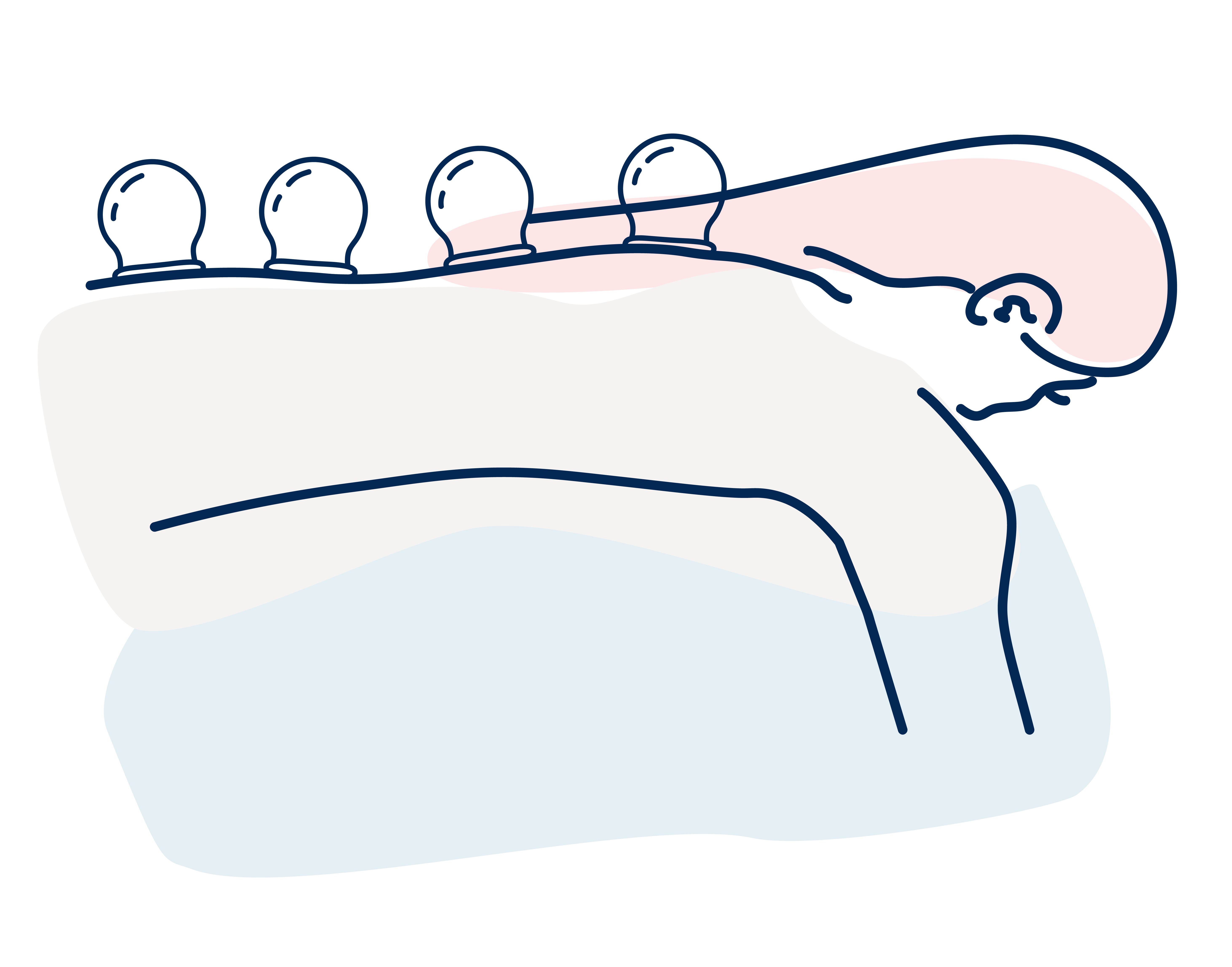 line illustrations of cupping massage