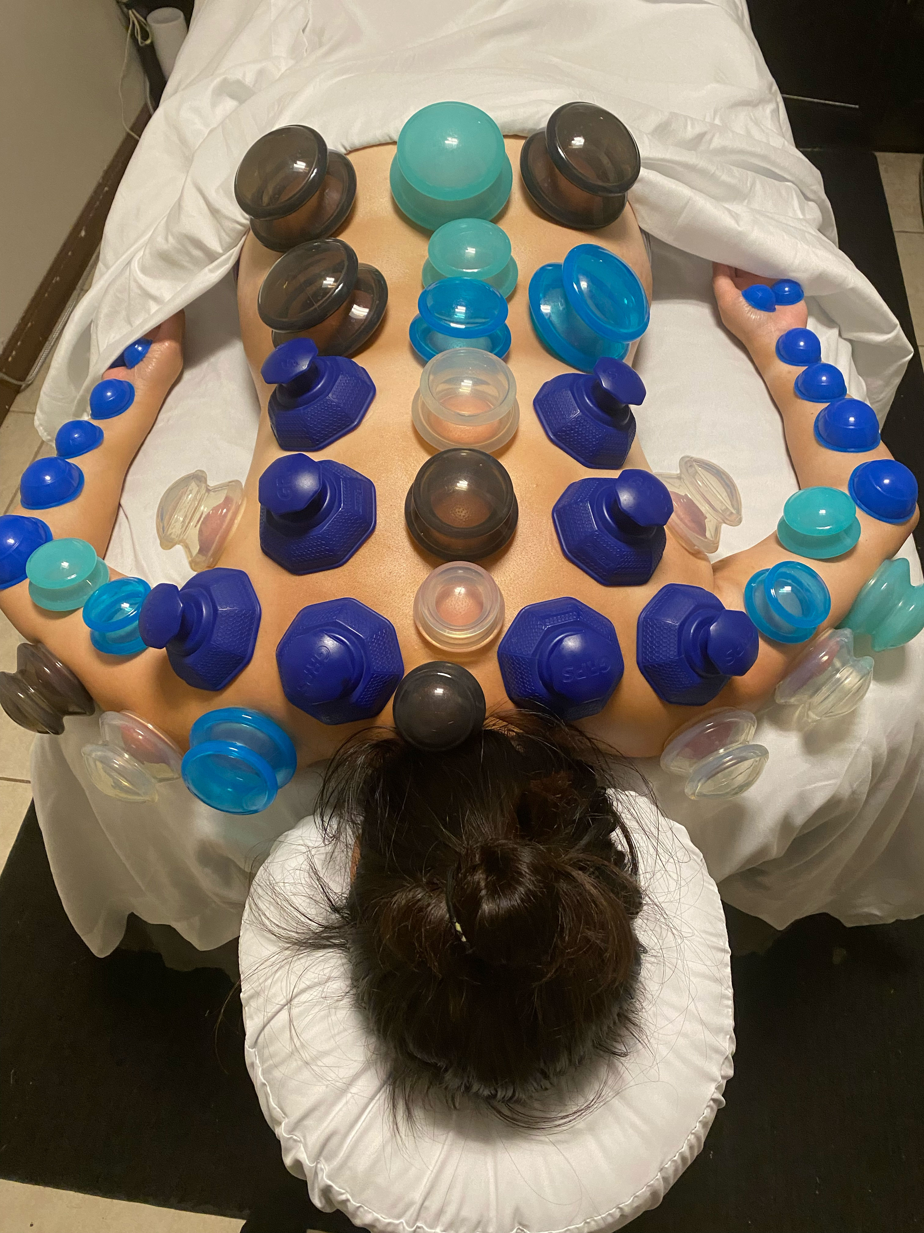 JKC WEllness cupping therapy