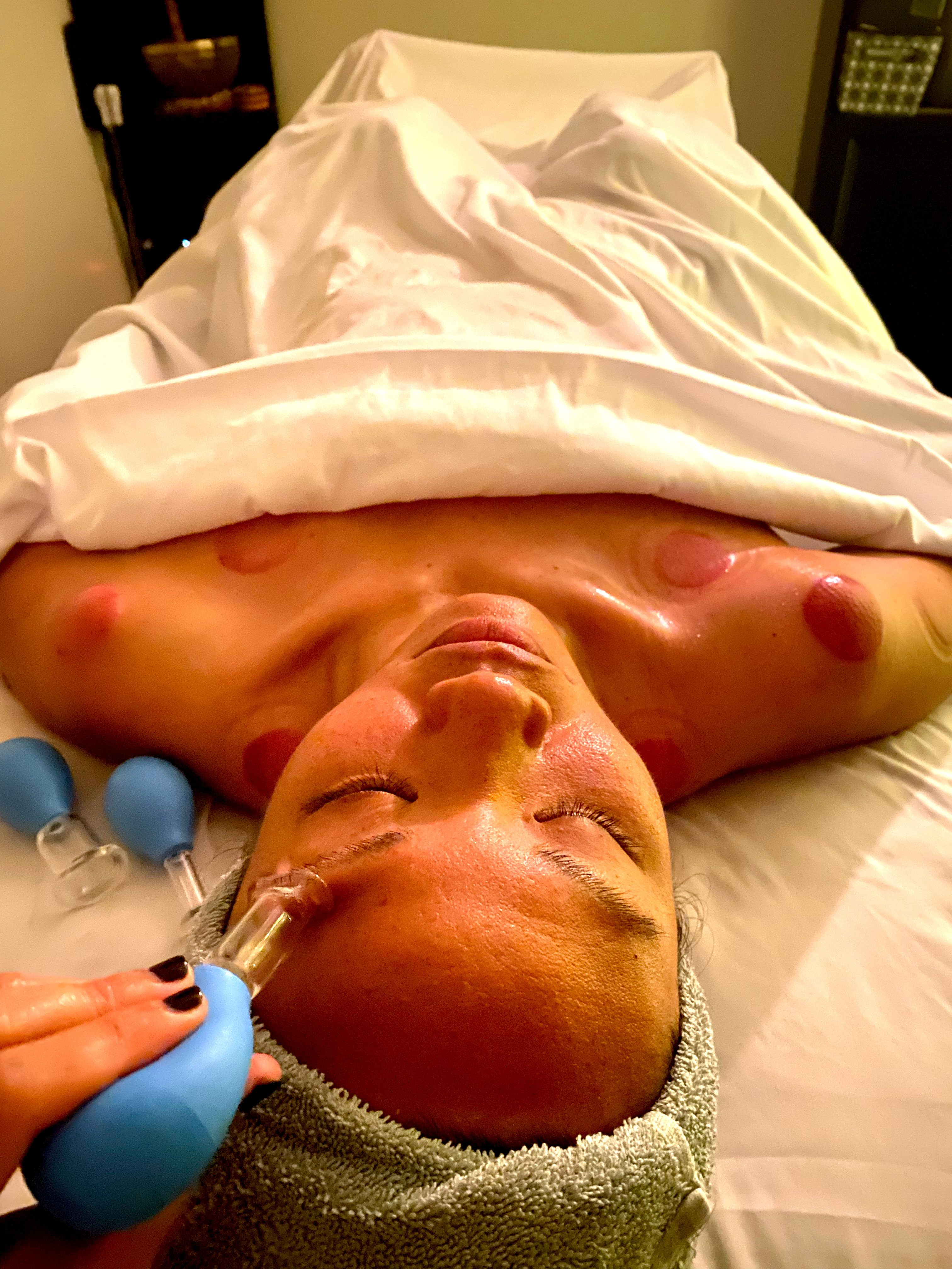 JKC Wellness Facial Cupping Therapy